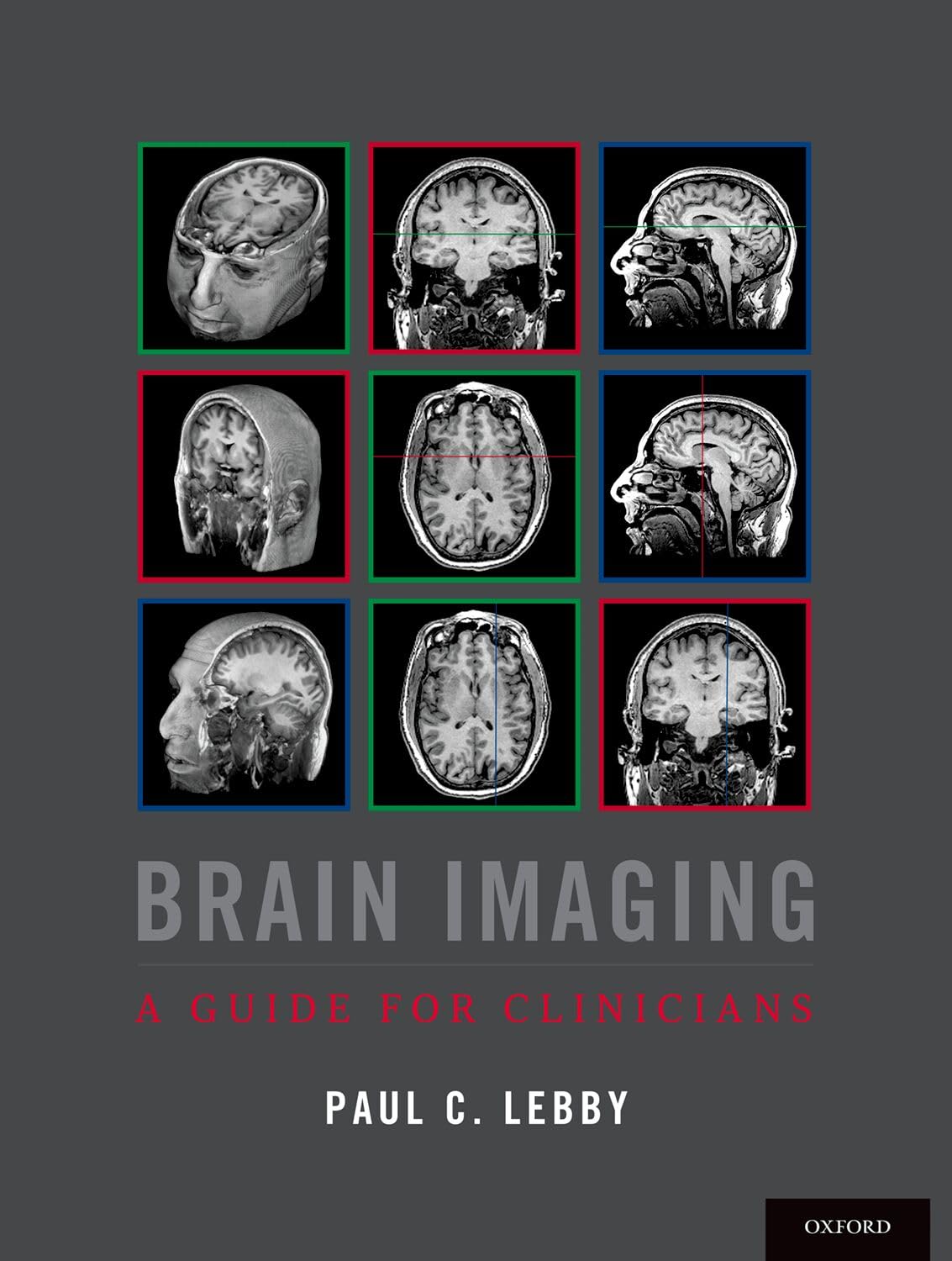BRAIN IMAGING