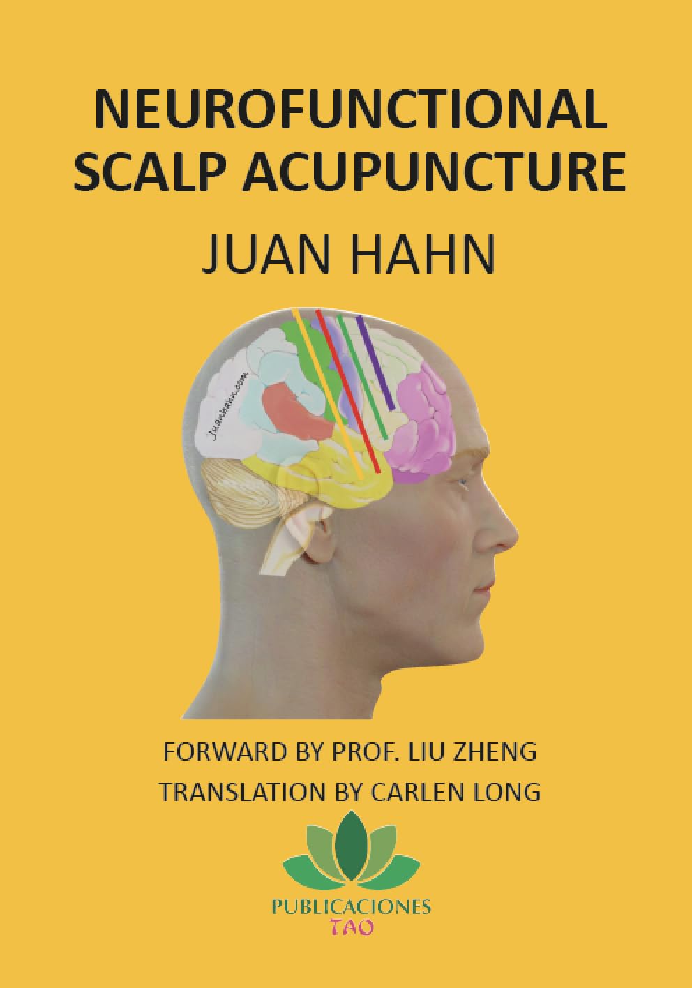 Neurofunctional scalp acupuncture