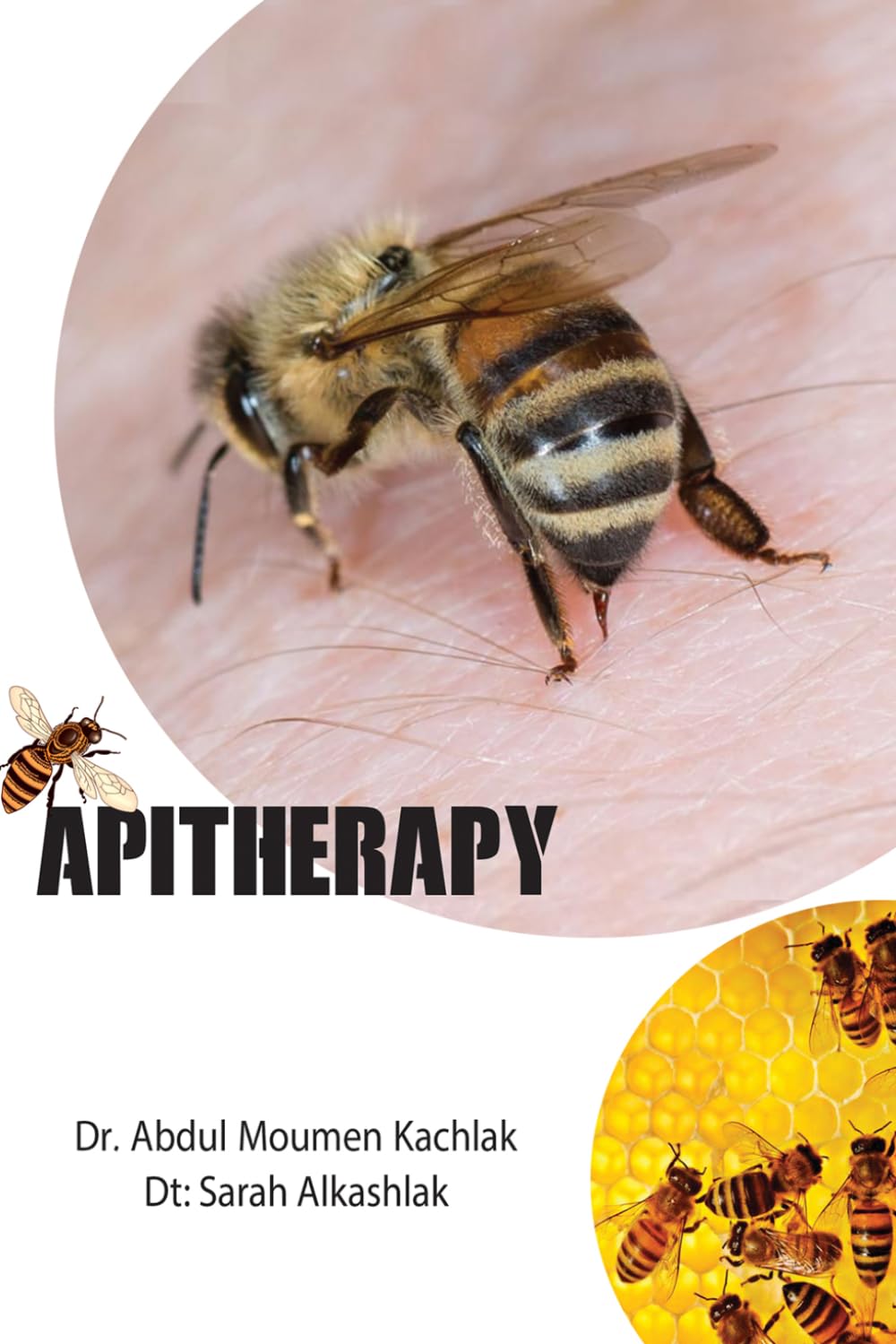 Apitherapy: Treatment with Bee Venom and Honey