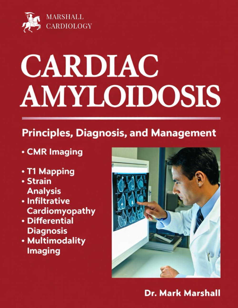 CARDIAC AMYLOIDOSIS: PRINCIPLES, DIAGNOSIS, AND MANAGEMENT