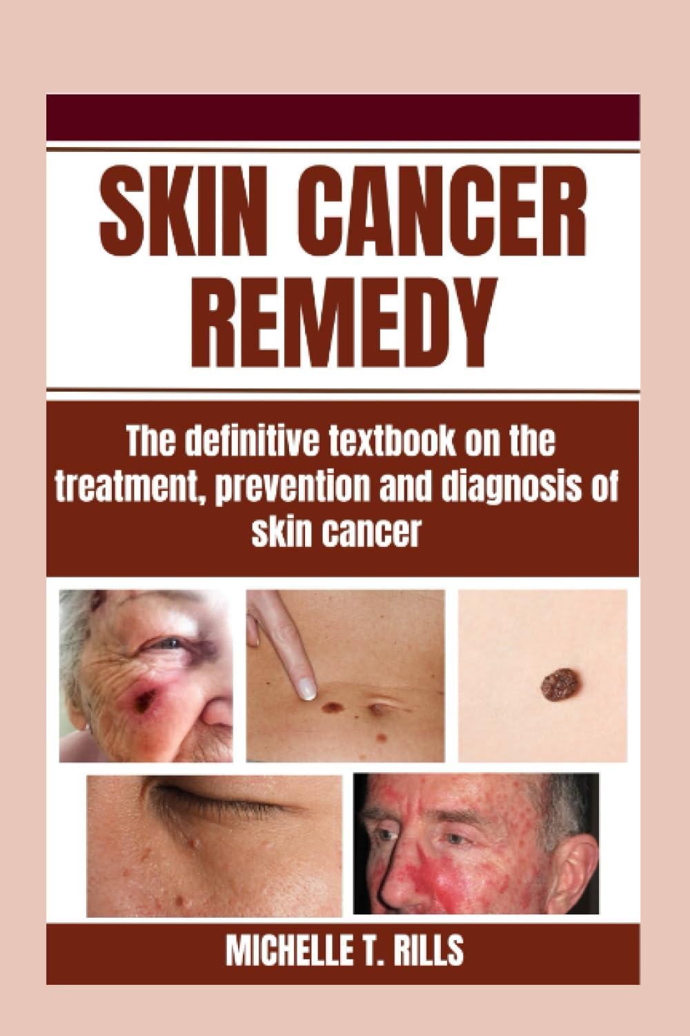 SKIN CANCER REMEDY: The definitive textbook on the treatment, prevention and diagnosis of skin cancer