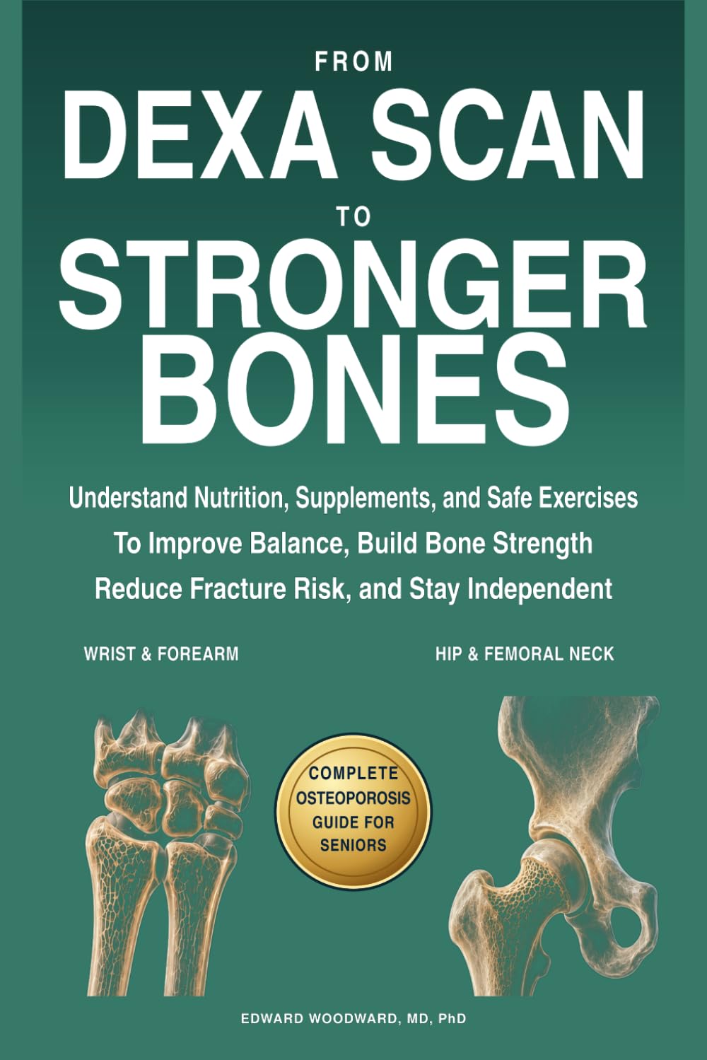 From DEXA Scan to Stronger Bones: Understand Nutrition, Supplements, and Safe Exercises to Improve Balance, Build Bone Strength, Reduce Fracture Risk, and Stay Independent