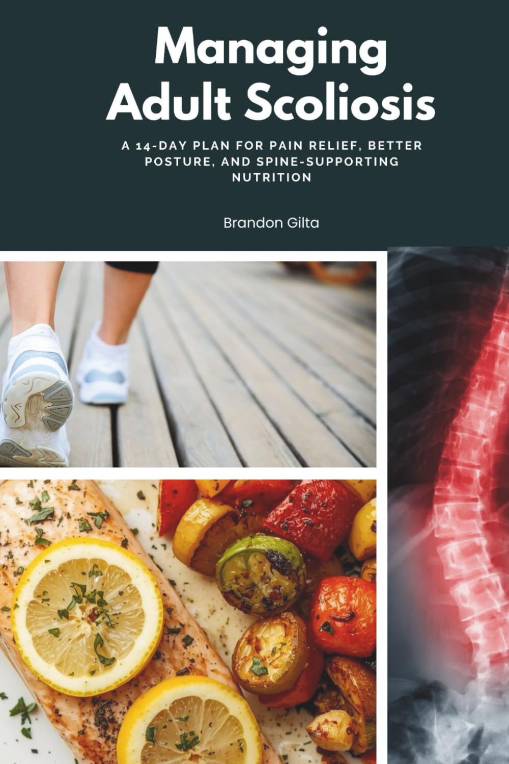 Managing Adult Scoliosis: A 14-Day Plan for Pain Relief, Better Posture, and Spine-Supporting Nutrition