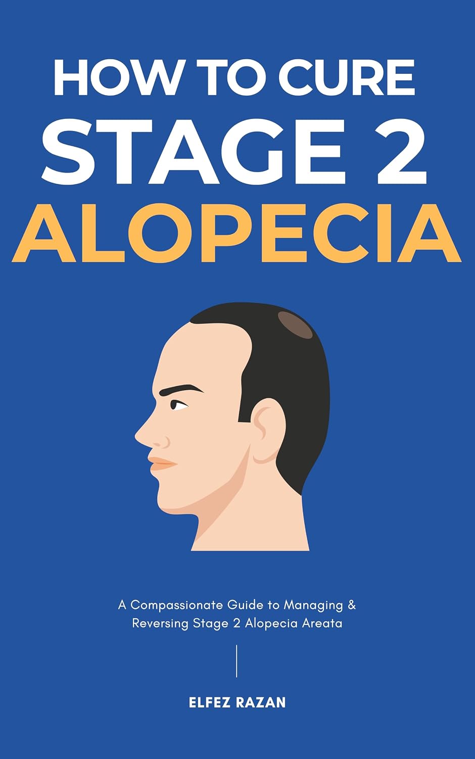 How To Cure Stage 2 Alopecia : A Holistic Guide to Stop Hair Loss, Reduce Inflammation, and Regrow Your Hair with Proven Treatments, Diet, and Stress Management (Hair Care)