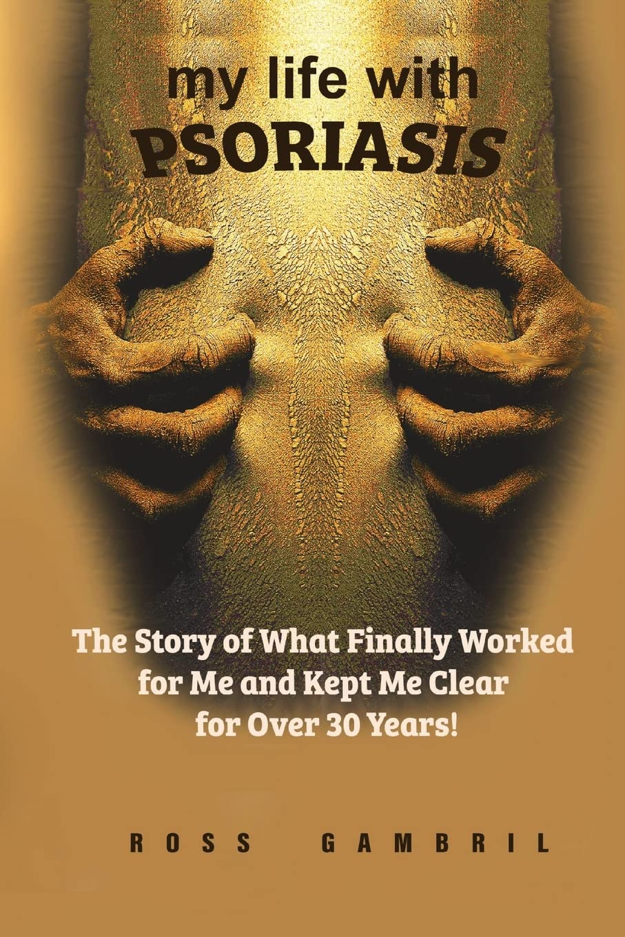 My life with Psoriasis: The Story of What Finally Worked for Me And Kept Me Clear For Over 30 Years