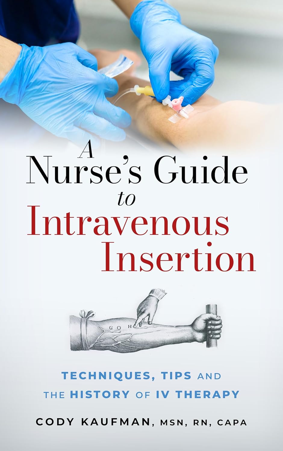 A Nurse's Guide to Intravenous Insertion: Techniques, Tips, and the History of IV Therapy