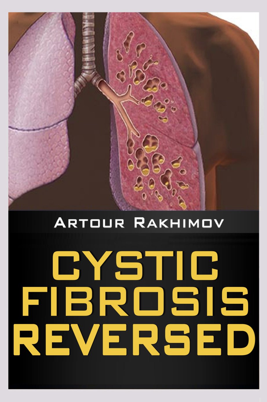 Cystic Fibrosis Life Expectancy: 30, 50, 70… (Health, Fitness and Dieting: Children's Health: Cystic Fibrosis Book 1)