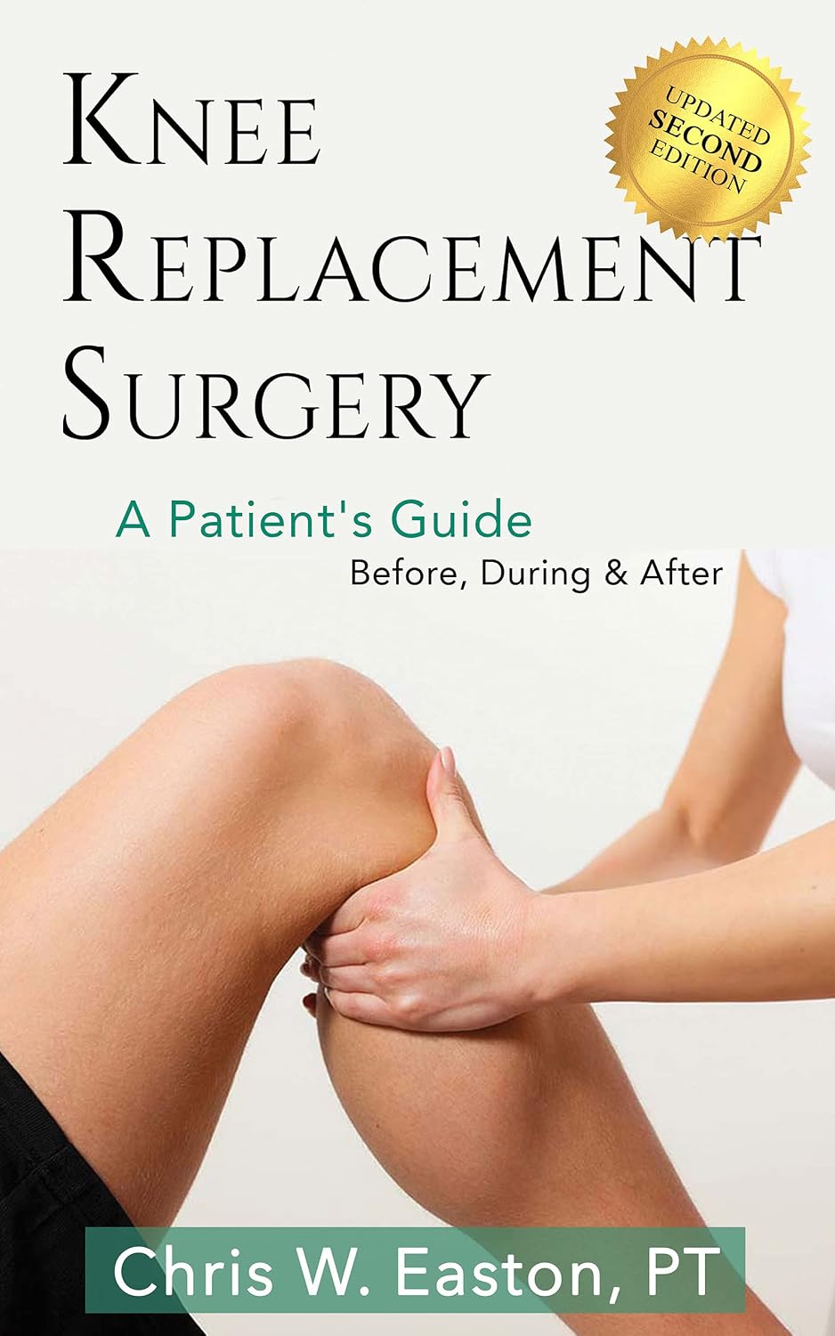 Knee Replacement Surgery, A Patient's Guide: Before, During & After