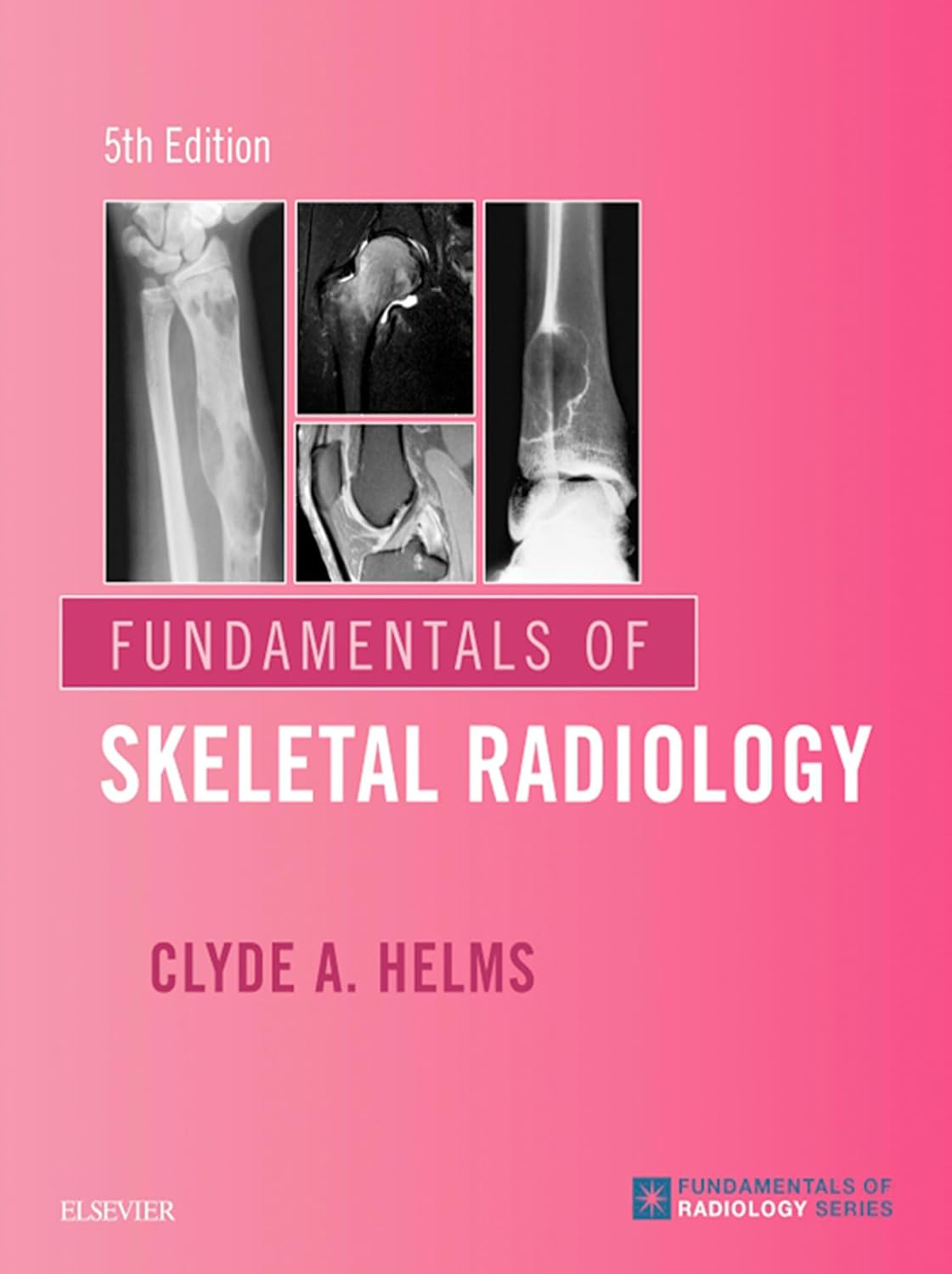 Fundamentals of Skeletal Radiology E-Book