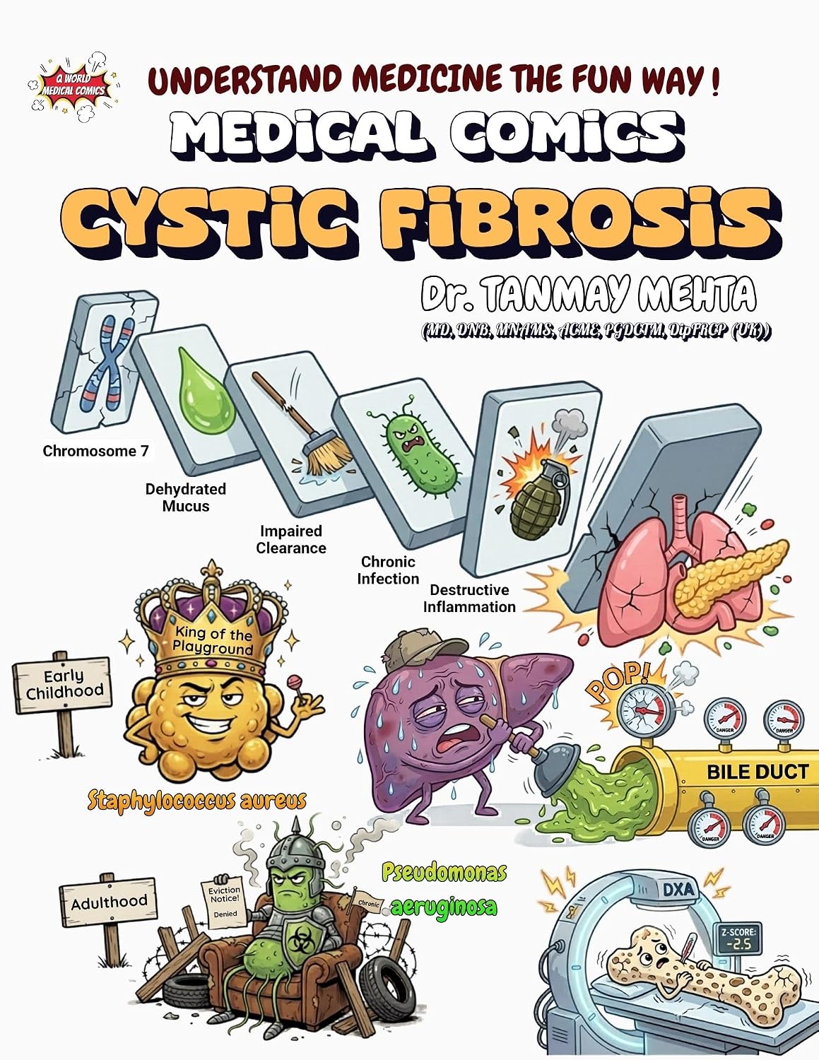 Cystic Fibrosis: Medical Comic Book