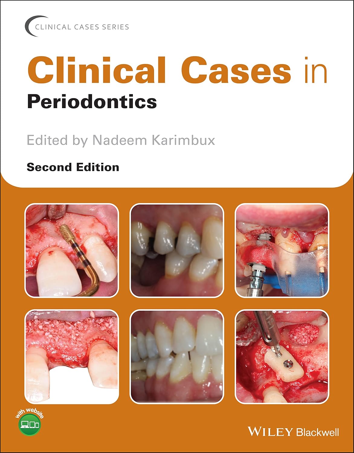 Clinical Cases in Periodontics (Clinical Cases (Dentistry))