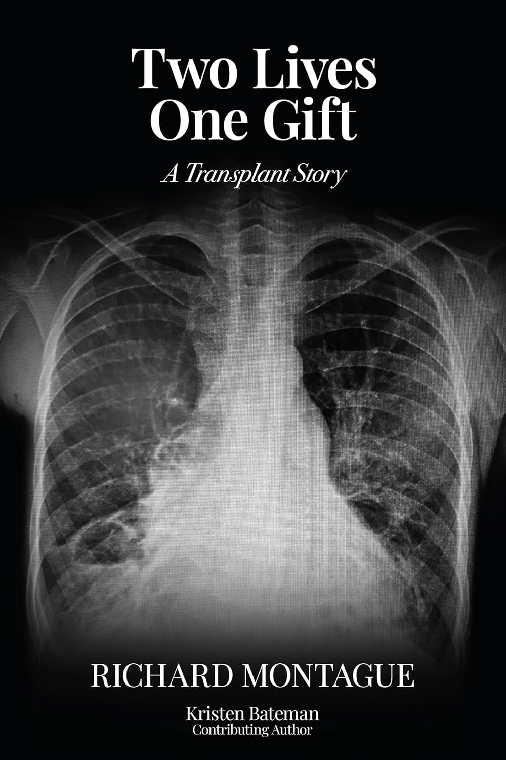 Two Lives One Gift: A Transplant Story