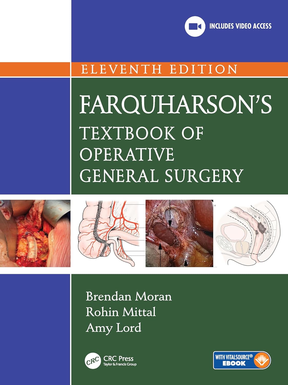 Farquharson's Textbook of Operative General Surgery