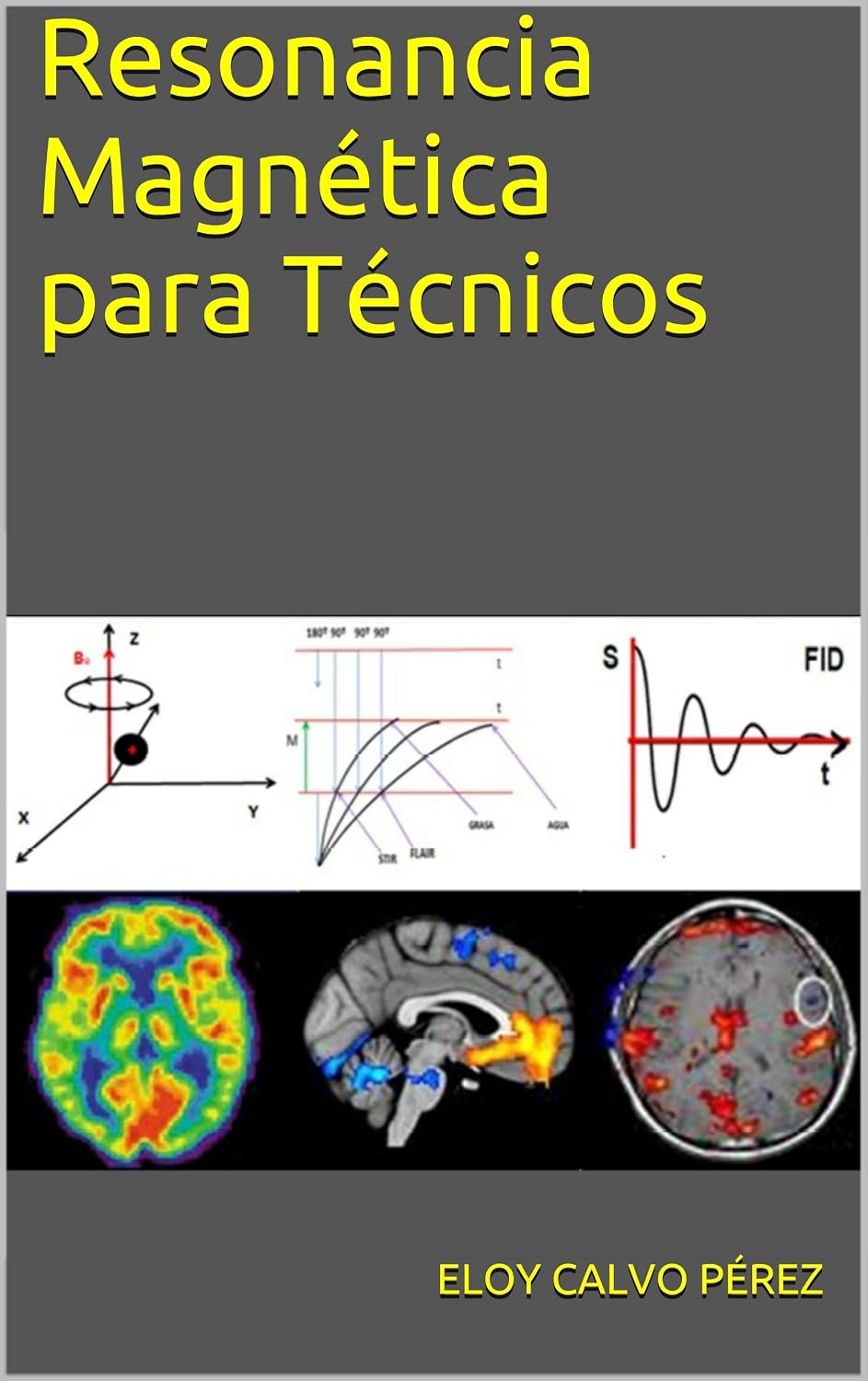 Resonancia Magnética para Técnicos: Conceptos básicos (Spanish Edition)