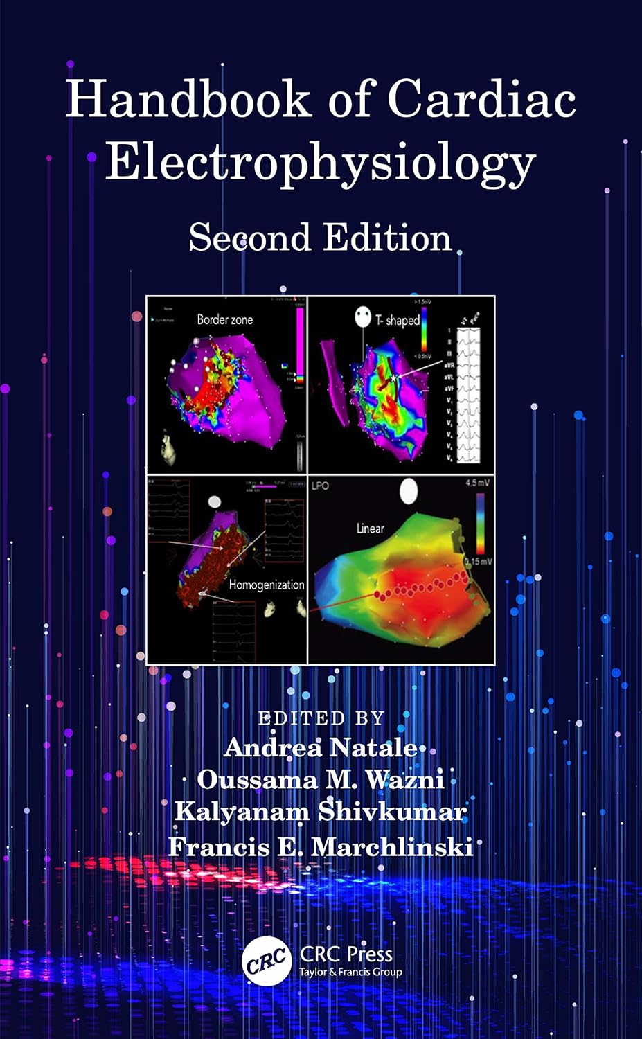 Handbook of Cardiac Electrophysiology: Second Edition
